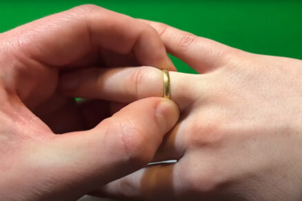 Ako dostať prsteň z opuchnutého prsta