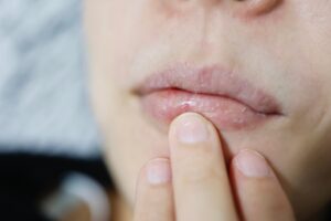 Popraskané pery a suché ruky zo zimy? Rýchlu pomoc prekvapivo nájdete v kuchyni